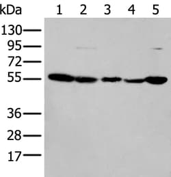 Invitrogen PFKFB3 Polyclonal Antibody 100 &mu;L; Unconjugated:Antibodies,