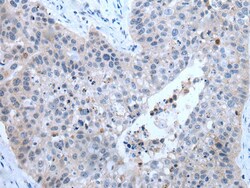 Invitrogen ZDHHC5 Polyclonal Antibody 100 &mu;L; Unconjugated:Antibodies,