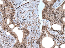 Invitrogen ZNF787 Polyclonal Antibody 100 &mu;L; Unconjugated:Antibodies,