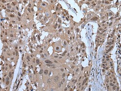 Invitrogen ZNF787 Polyclonal Antibody 100 &mu;L; Unconjugated:Antibodies,