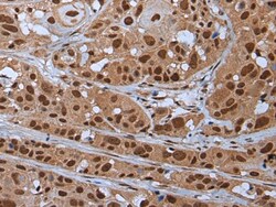 Invitrogen YY2 Polyclonal Antibody 100 &mu;L; Unconjugated:Antibodies,