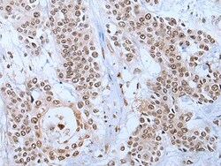 Invitrogen YY2 Polyclonal Antibody 100 &mu;L; Unconjugated:Antibodies,
