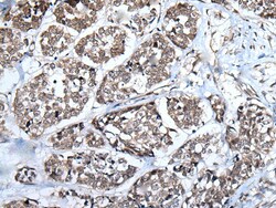 Invitrogen WEE1 Polyclonal Antibody 100 &mu;L; Unconjugated:Antibodies,