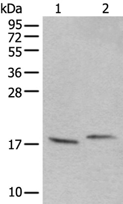 Invitrogen UBA52 Polyclonal Antibody 100 &mu;L | Buy Online | Invitrogen&trade; | Fisher Scientific