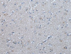 Invitrogen UBR4 Polyclonal Antibody 100 &mu;L; Unconjugated:Antibodies,