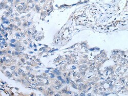Invitrogen UBR4 Polyclonal Antibody 100 &mu;L; Unconjugated:Antibodies,