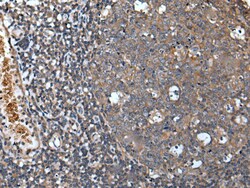 Invitrogen UNC5A Polyclonal Antibody 100 &mu;L | Buy Online | Invitrogen&trade; | Fisher Scientific