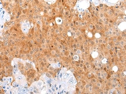 Invitrogen AKIP1 Polyclonal Antibody 100 &mu;L; Unconjugated:Antibodies,