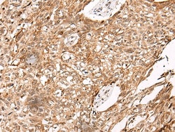 NO66 Polyclonal Antibody, Invitrogen 100 &mu;L; Unconjugated:Antibodies,