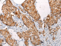 Invitrogen EMC7 Polyclonal Antibody 100 &mu;L | Buy Online | Invitrogen&trade; | Fisher Scientific