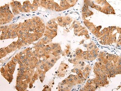 Invitrogen EMC7 Polyclonal Antibody 100 &mu;L | Buy Online | Invitrogen&trade; | Fisher Scientific