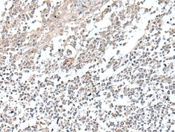 Invitrogen VGLL2 Polyclonal Antibody 100 &mu;L | Buy Online | Invitrogen&trade; | Fisher Scientific