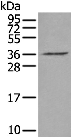 Invitrogen VGLL2 Polyclonal Antibody 100 &mu;L | Buy Online | Invitrogen&trade; | Fisher Scientific