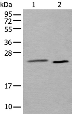 Invitrogen UBE2T Polyclonal Antibody 100 &mu;L | Buy Online | Invitrogen&trade; | Fisher Scientific