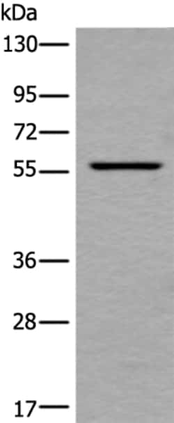 Invitrogen UBOX5 Polyclonal Antibody 100 &mu;L; Unconjugated:Antibodies,