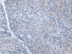 Invitrogen HIN-1 Polyclonal Antibody 100 &mu;L | Buy Online | Invitrogen&trade; | Fisher Scientific