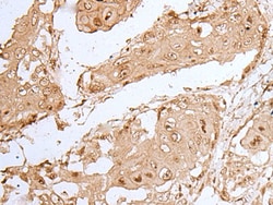 HOXC9 Polyclonal Antibody, Invitrogen&trade; 100 &mu;L; Unconjugated 