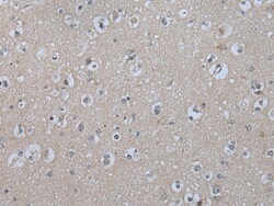 Invitrogen IL9R Polyclonal Antibody 100 &mu;L; Unconjugated:Antibodies,