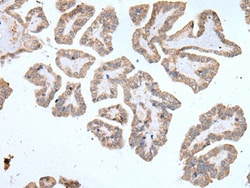 Invitrogen ABCD1 Polyclonal Antibody 100 &mu;L; Unconjugated:Antibodies,