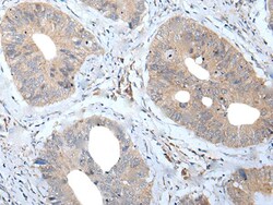 Invitrogen MATN2 Polyclonal Antibody 100 &mu;L; Unconjugated:Antibodies,