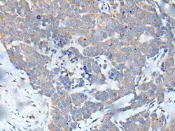Invitrogen MATN2 Polyclonal Antibody 100 &mu;L; Unconjugated:Antibodies,