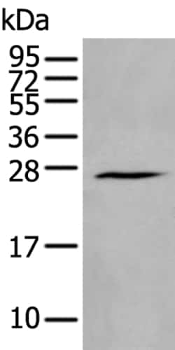Invitrogen HAND1 Polyclonal Antibody 100 &mu;L; Unconjugated:Antibodies,