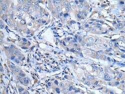 Invitrogen LTBP4 Polyclonal Antibody 100 &mu;L; Unconjugated:Antibodies,