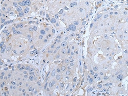 Invitrogen LTBP4 Polyclonal Antibody 100 &mu;L; Unconjugated:Antibodies,