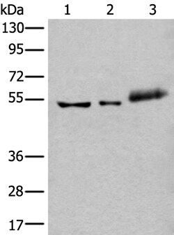 Invitrogen YY2 Polyclonal Antibody 100 &mu;L; Unconjugated:Anticuerpos