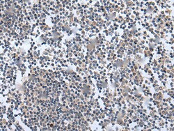 Invitrogen WNT5A Polyclonal Antibody 100 &mu;L; Unconjugated:Antibodies,