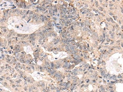 Invitrogen MEDAG Polyclonal Antibody 100 &mu;L; Unconjugated:Antibodies,