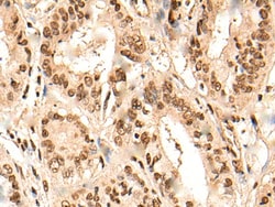 Invitrogen RMP Polyclonal Antibody 100 &mu;L; Unconjugated:Antibodies,