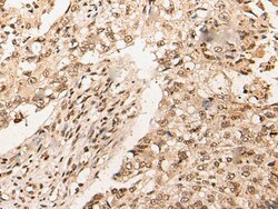 Invitrogen RMP Polyclonal Antibody 100 &mu;L; Unconjugated:Antibodies,