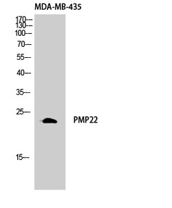 Invitrogen PMP22 Polyclonal Antibody 100 &mu;L; Unconjugated:Antibodies,