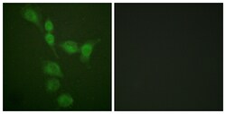 Invitrogen PKA alpha/beta/gamma Polyclonal Antibody 100 &mu;L; Unconjugated:Antibodies,