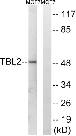 Invitrogen TBL2 Polyclonal Antibody 100 &mu;L; Unconjugated:Antibodies,