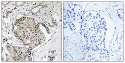 Invitrogen USP40 Polyclonal Antibody 100 &mu;L; Unconjugated:Antibodies,
