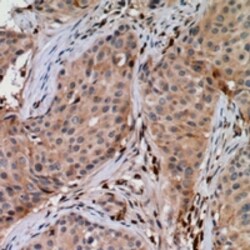 Invitrogen UBE2G1 Polyclonal Antibody 100 &mu;L; Unconjugated:Antibodies,