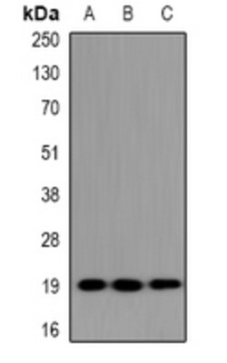 Invitrogen UBE2G1 Polyclonal Antibody 100 &mu;L; Unconjugated:Antibodies,