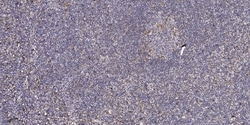 Invitrogen CYP4Z1/CYP4Z2P Polyclonal Antibody 100 &mu;L; Unconjugated:Antibodies,