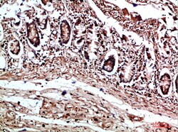 Invitrogen COL17A1 Polyclonal Antibody 100 &mu;L; Unconjugated:Antibodies,