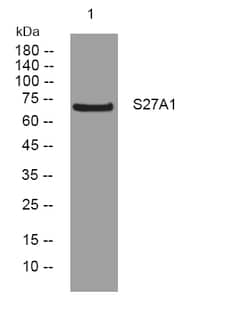 Invitrogen SLC27A1 Polyclonal Antibody 100 &mu;L | Buy Online | Invitrogen&trade; | Fisher Scientific