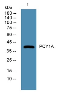 Invitrogen PCYT1A Polyclonal Antibody 100 &mu;L | Buy Online | Invitrogen&trade; | Fisher Scientific