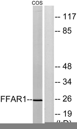 Invitrogen GPR40 Polyclonal Antibody 100 &mu;L; Unconjugated:Antibodies,