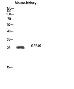 Invitrogen GPR40 Polyclonal Antibody 100 &mu;L; Unconjugated:Antibodies,
