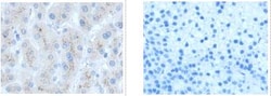Invitrogen GBA Polyclonal Antibody 100 &mu;L; Unconjugated:Antibodies,