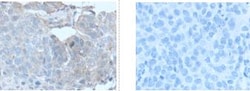 Invitrogen GBA Polyclonal Antibody 100 &mu;L; Unconjugated:Antibodies,