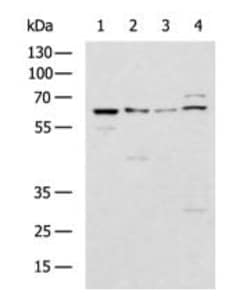 Invitrogen GBA Polyclonal Antibody 100 &mu;L; Unconjugated:Antibodies,