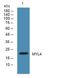 Invitrogen MYL4 Polyclonal Antibody 100 &mu;L | Buy Online | Invitrogen&trade; | Fisher Scientific
