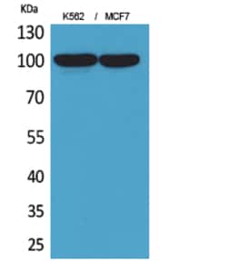 Invitrogen CD203c Polyclonal Antibody 100 &mu;L; Unconjugated:Anticuerpos